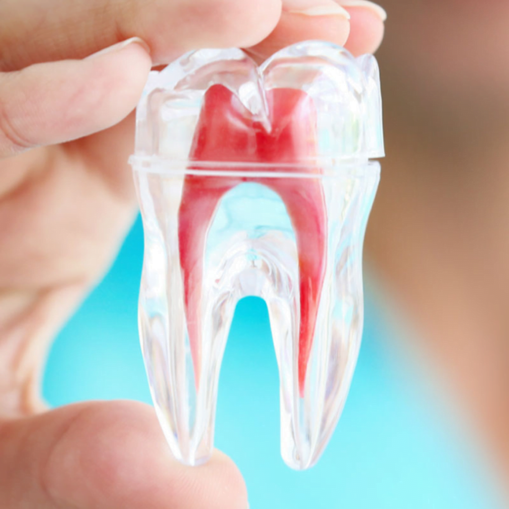 best root canal treatment in hyderabad